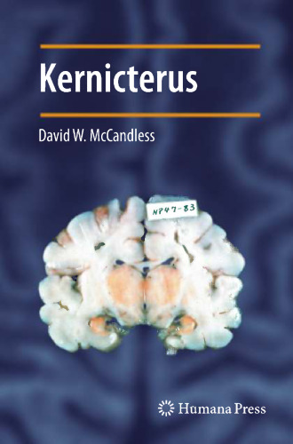 Kernicterus
