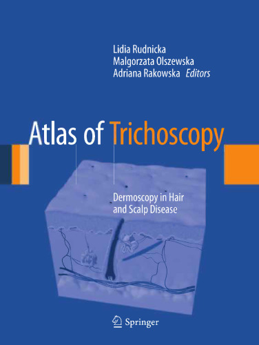 Atlas of Trichoscopy: Dermoscopy in Hair and Scalp Disease