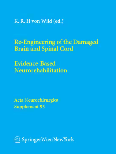 Re-Engineering of the Damaged Brain and Spinal Cord: Evidence-Based Neurorehabilitation