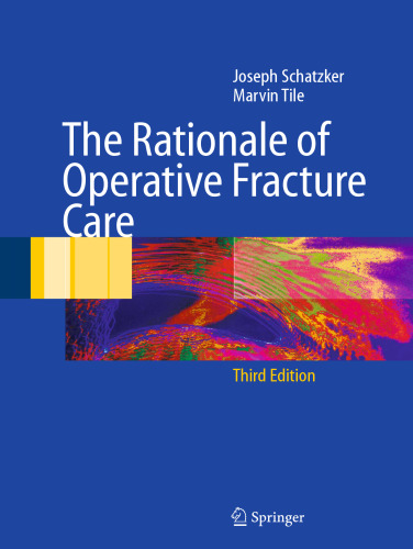 The Rationale of Operative Fracture Care