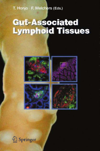 Gut-Associated Lymphoid Tissues