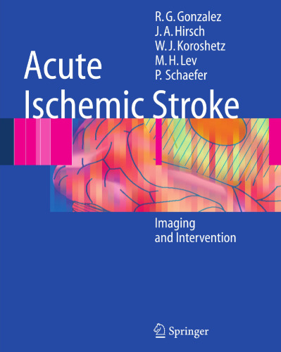 Acute Ischemic Stroke: Imaging and Intervention