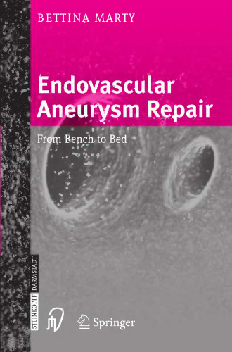 Endovascular Aneurysm Repair: From Bench to Bed