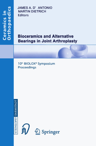 Bioceramics and Alternative Bearings in Joint Arthroplasty