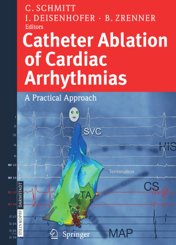 Catheter Ablation of Cardiac Arrhythmias: A Practical Approach