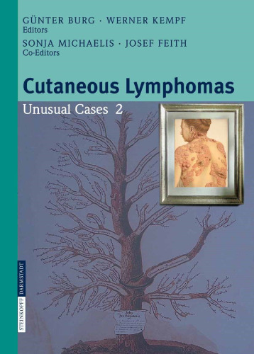 Cutaneous Lymphomas Unusual Cases 2