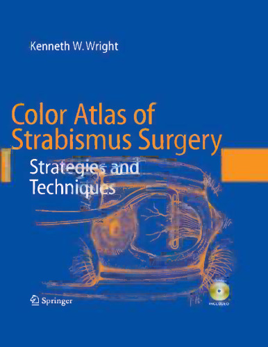 Color Atlas of Strabismus Surgery: Strategies and Techniques