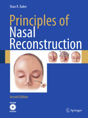 Principles of Nasal Reconstruction