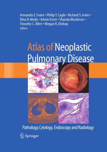 Atlas of Neoplastic Pulmonary Disease: Pathology, Cytology, Endoscopy and Radiology