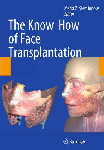 The Know-How of Face Transplantation