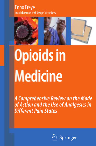 Opioids in Medicine: A Comprehensive Review on the Mode of Action and the Use of Analgesics in Different Clinical Pain States