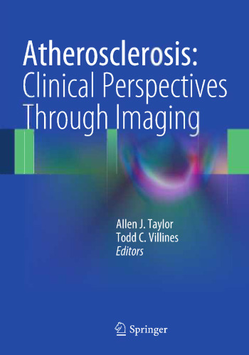 Atherosclerosis: Clinical Perspectives Through Imaging