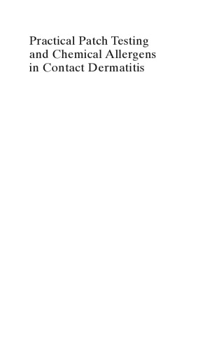 Practical Patch Testing and Chemical Allergens in Contact Dermatitis