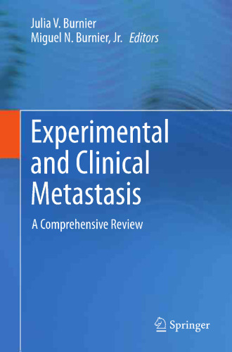 Experimental and Clinical Metastasis: A Comprehensive Review