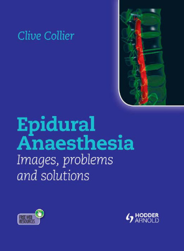 Epidural anaesthesia : images, problems and solutions