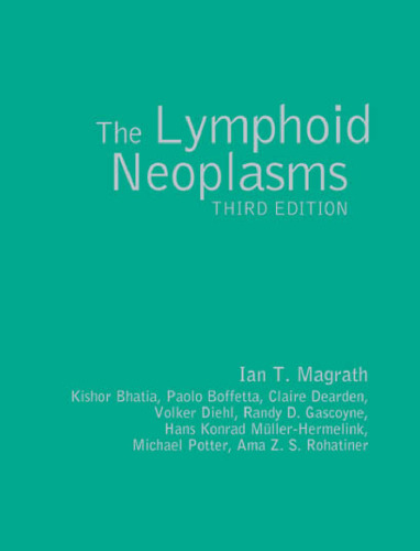 The lymphoid neoplasms