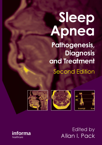 Sleep apnea : pathogenesis, diagnosis, and treatment