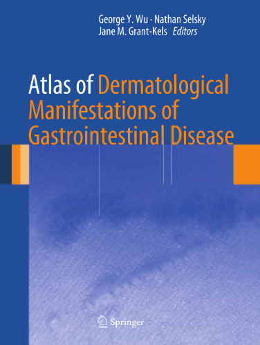 Atlas of Dermatological Manifestations of Gastrointestinal Disease