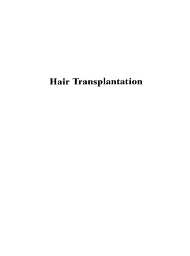 Hair Transplantation, Fourth Edition
