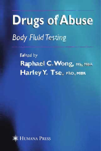 Drugs of Abuse: Body Fluid Testing