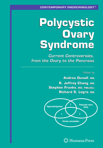 Polycystic Ovary Syndrome: Current Controversies, From The Ovary To The Pancreas