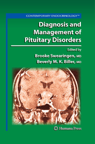 Diagnosis and Management of Pituitary Disorders