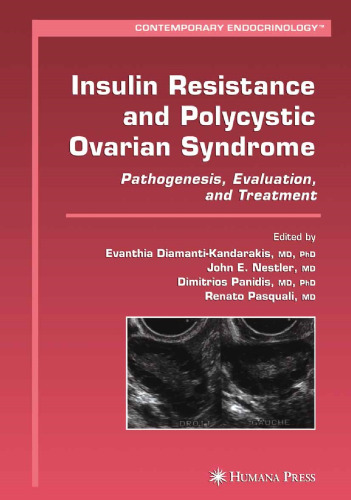 Insulin Resistance and Polycystic Ovarian Syndrome: Pathogenesis, Evaluation, and Treatment
