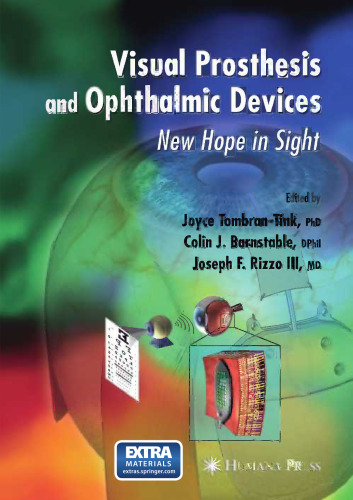 Visual Prosthesis and Ophthalmic Devices: New Hope in Sight