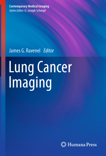 Lung Cancer Imaging