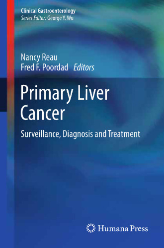 Primary Liver Cancer: Surveillance, Diagnosis and Treatment
