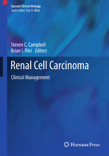 Renal Cell Carcinoma: Clinical Management
