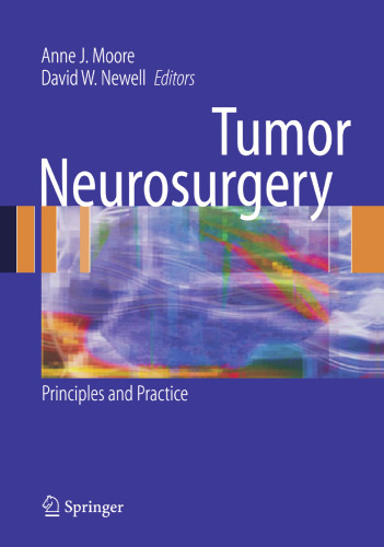 Tumor Neurosurgery: Principles and Practice