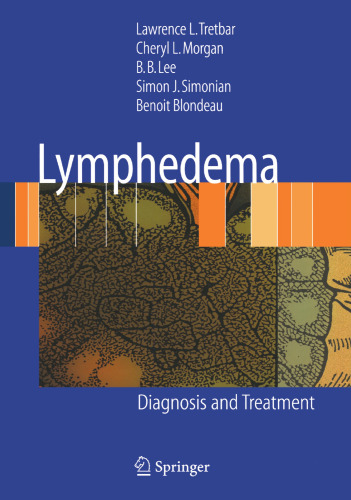 Lymphedema: Diagnosis and Treatment
