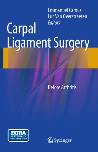 Carpal Ligament Surgery: Before Arthritis
