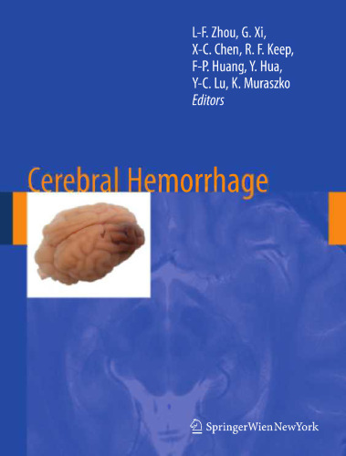 Cerebral Hemorrhage