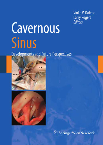 Cavernous Sinus: Developments and Future Perspectives