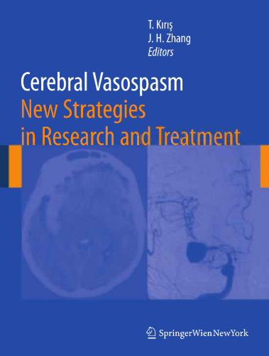 Cerebral Vasospasm: New Strategies in Research and Treatment