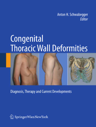 Congenital Thoracic Wall Deformities: Diagnosis, Therapy and Current Developments
