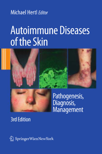 Autoimmune Diseases of the Skin: Pathogenesis, Diagnosis, Management