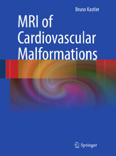MRI of Cardiovascular Malformations