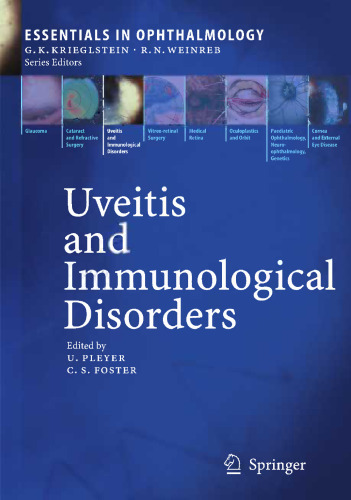 Uveitis and Immunological Disorders