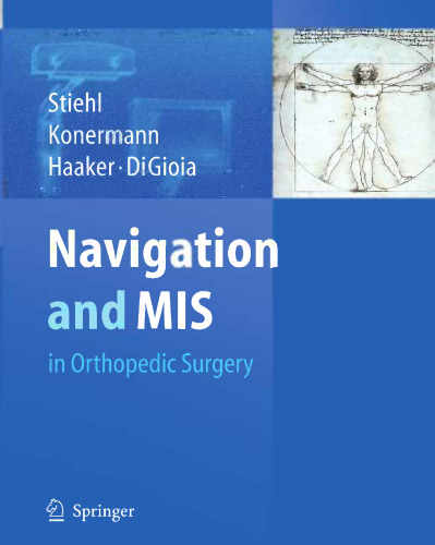 Navigation and MIS in Orthopedic Surgery