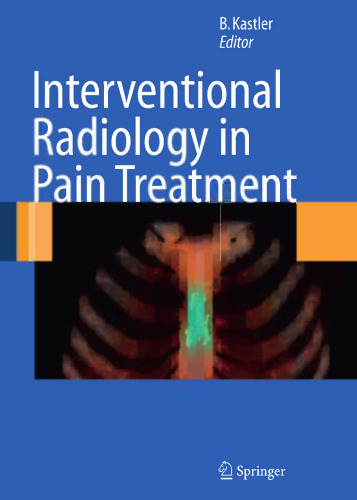 Interventional Radiology in Pain Treatment