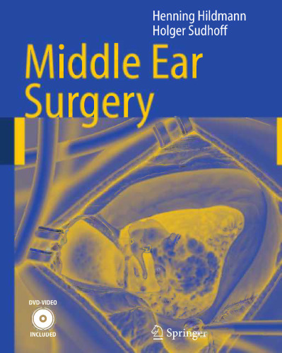 Middle Ear Surgery