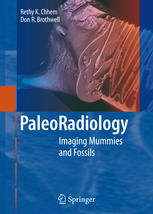 Paleoradiology: Imaging Mummies and Fossils