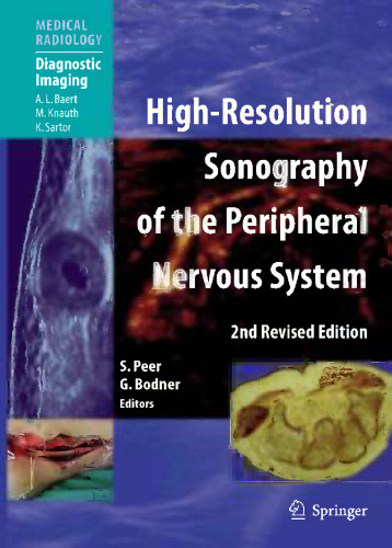 High-Resolution Sonography of the Peripheral Nervous System