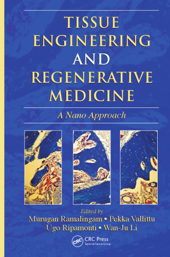 Tissue Engineering and Regenerative Medicine: A Nano Approach