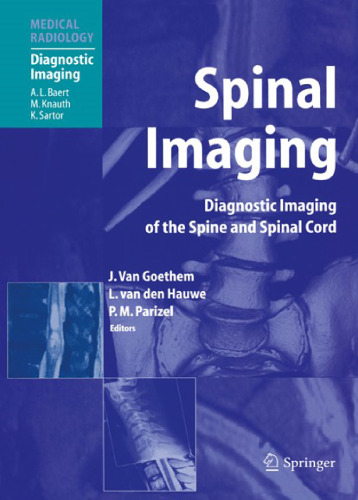 Spinal Imaging: Diagnostic Imaging of the Spine and Spinal Cord