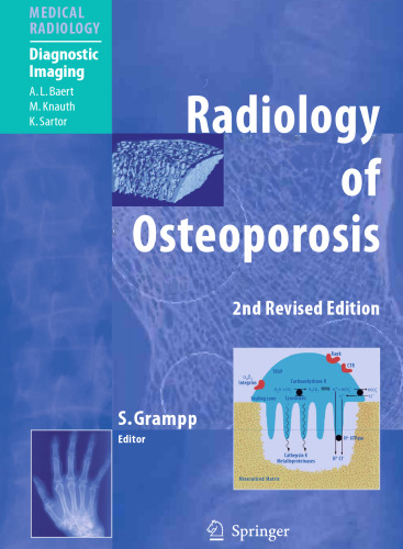 Radiology of Osteoporosis