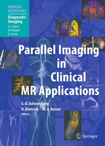 Parallel Imaging in Clinical MR Applications